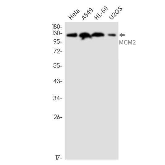 MCM2 Rabbit Monoclonal Antibody