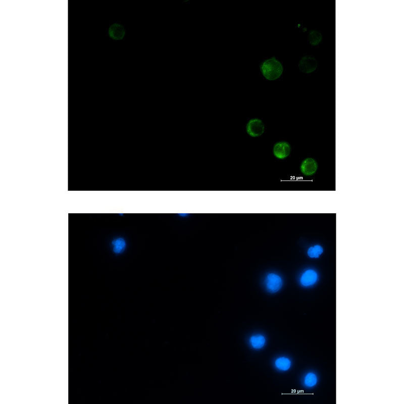 ME2 Rabbit Monoclonal Antibody