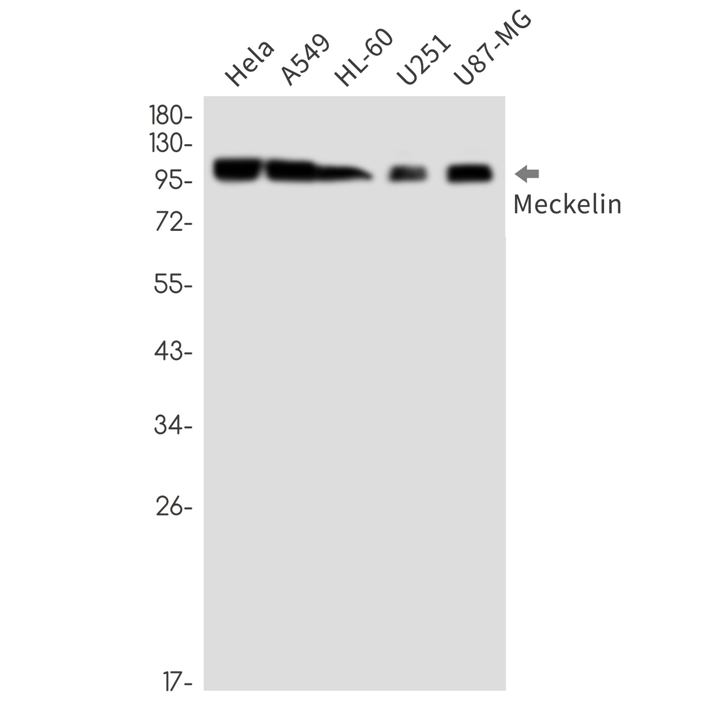Meckelin Rabbit Monoclonal Antibody