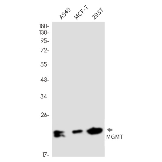 MGMT Rabbit Monoclonal Antibody