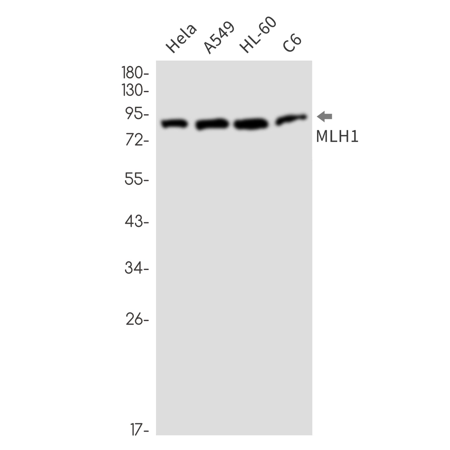 MLH1 Rabbit Monoclonal Antibody