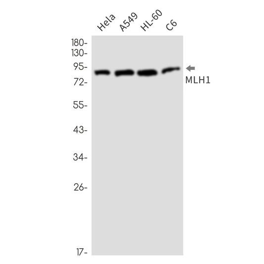 MLH1 Rabbit Monoclonal Antibody