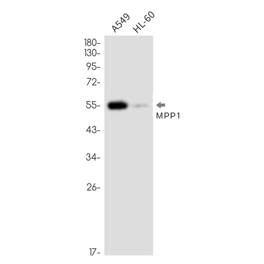 MPP1 Rabbit Monoclonal Antibody