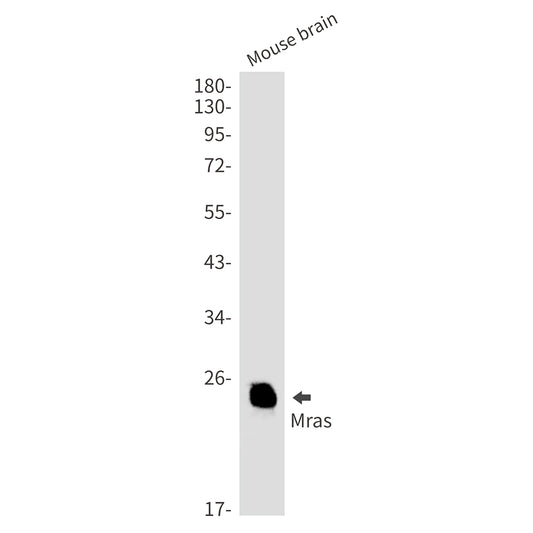 MRAS Rabbit Monoclonal Antibody