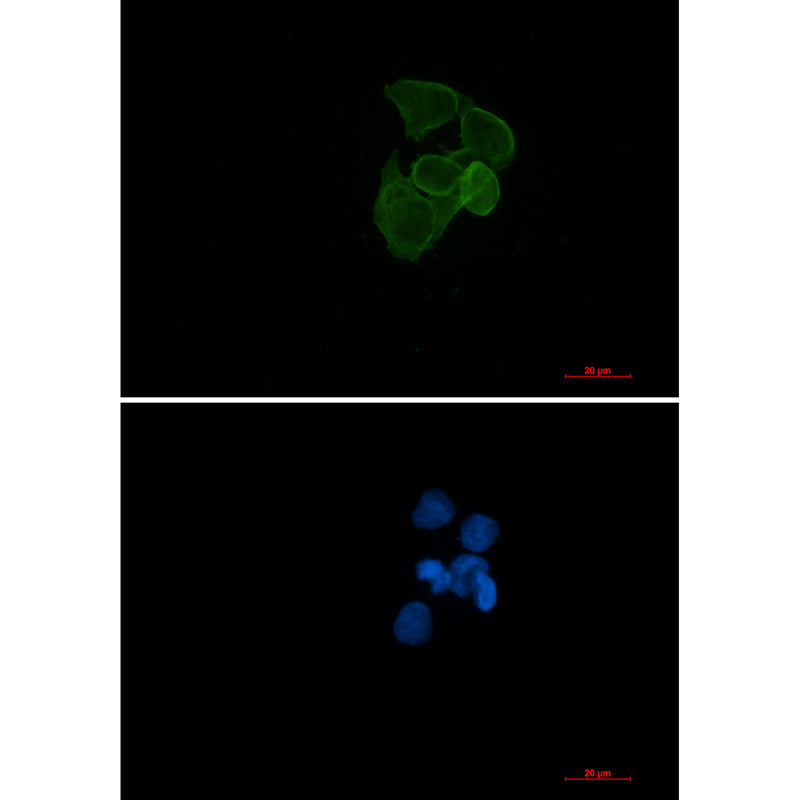 alpha Skeletal Muscle Actin Rabbit Monoclonal Antibody