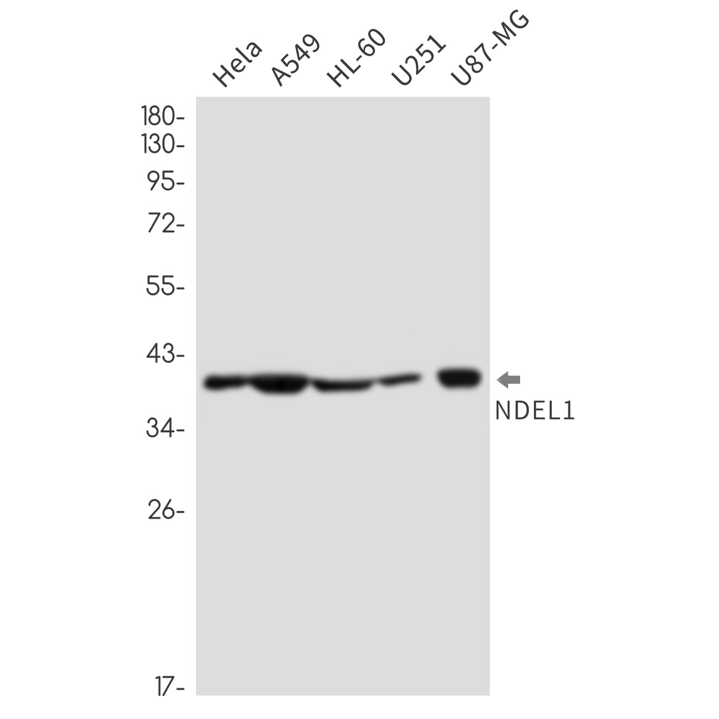 NDEL1 Rabbit Monoclonal Antibody