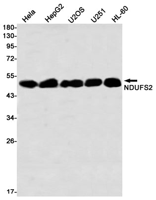 NDUFS2 Rabbit Monoclonal Antibody
