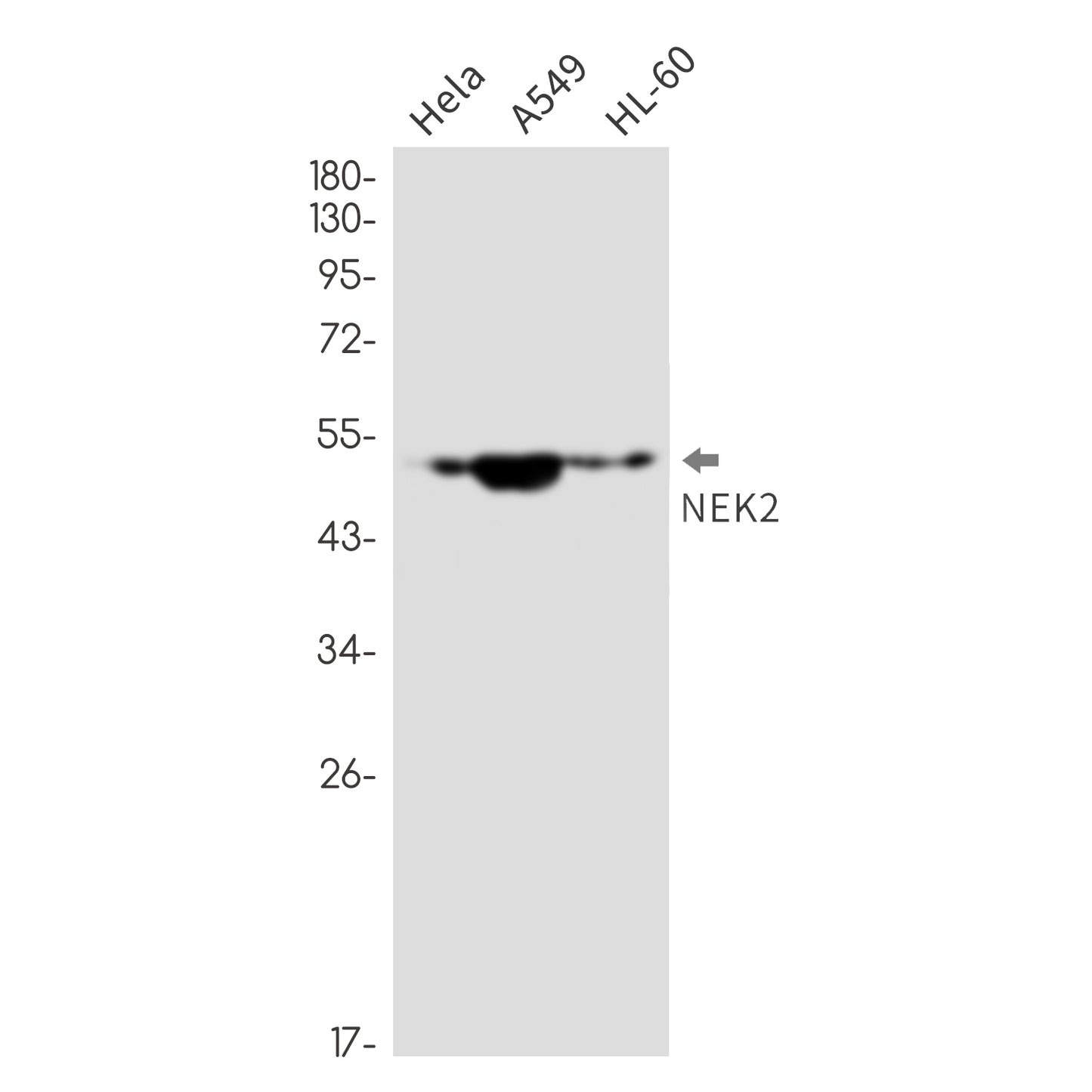 NEK2 Rabbit Monoclonal Antibody
