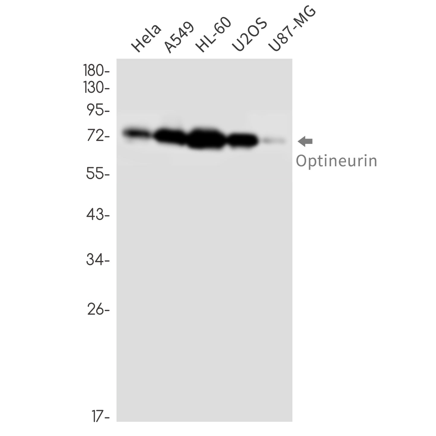 Optineurin Rabbit Monoclonal Antibody