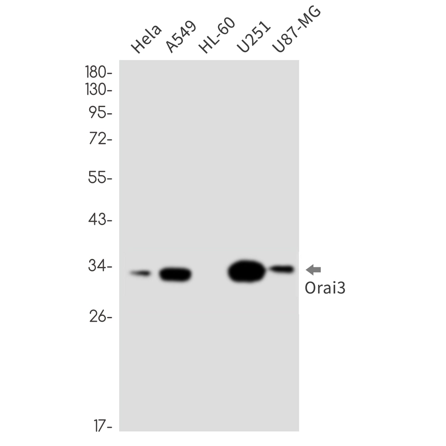 ORAI3 Rabbit Monoclonal Antibody