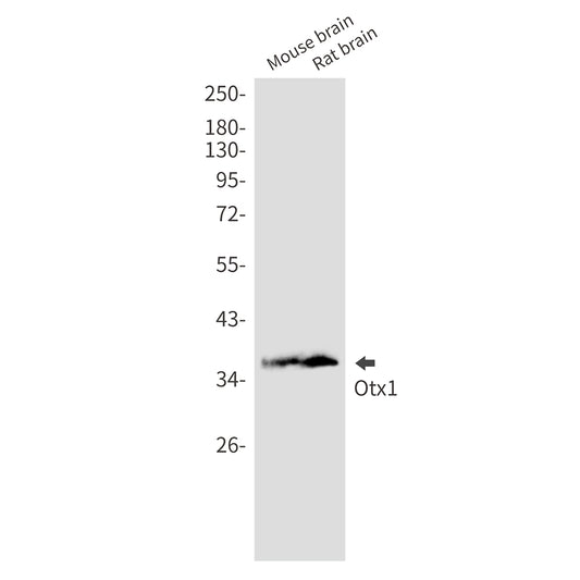 OTX1 Rabbit Monoclonal Antibody