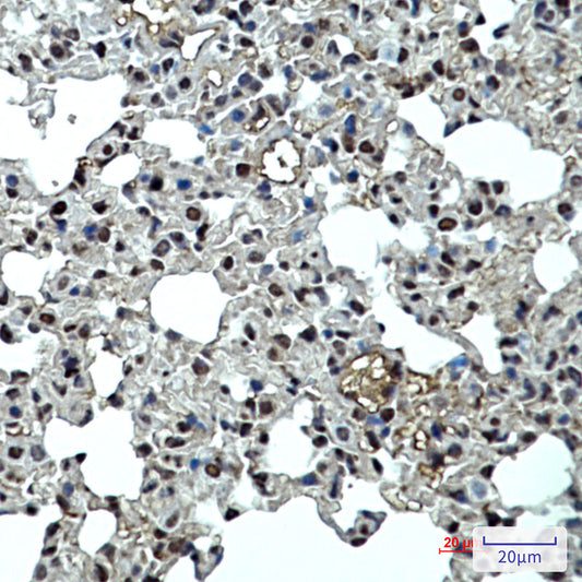 p27 Kip 1 Rabbit Monoclonal Antibody