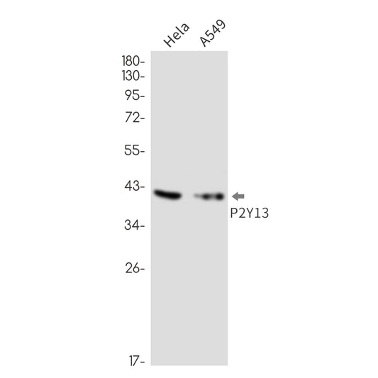 P2Y13 Rabbit Monoclonal Antibody