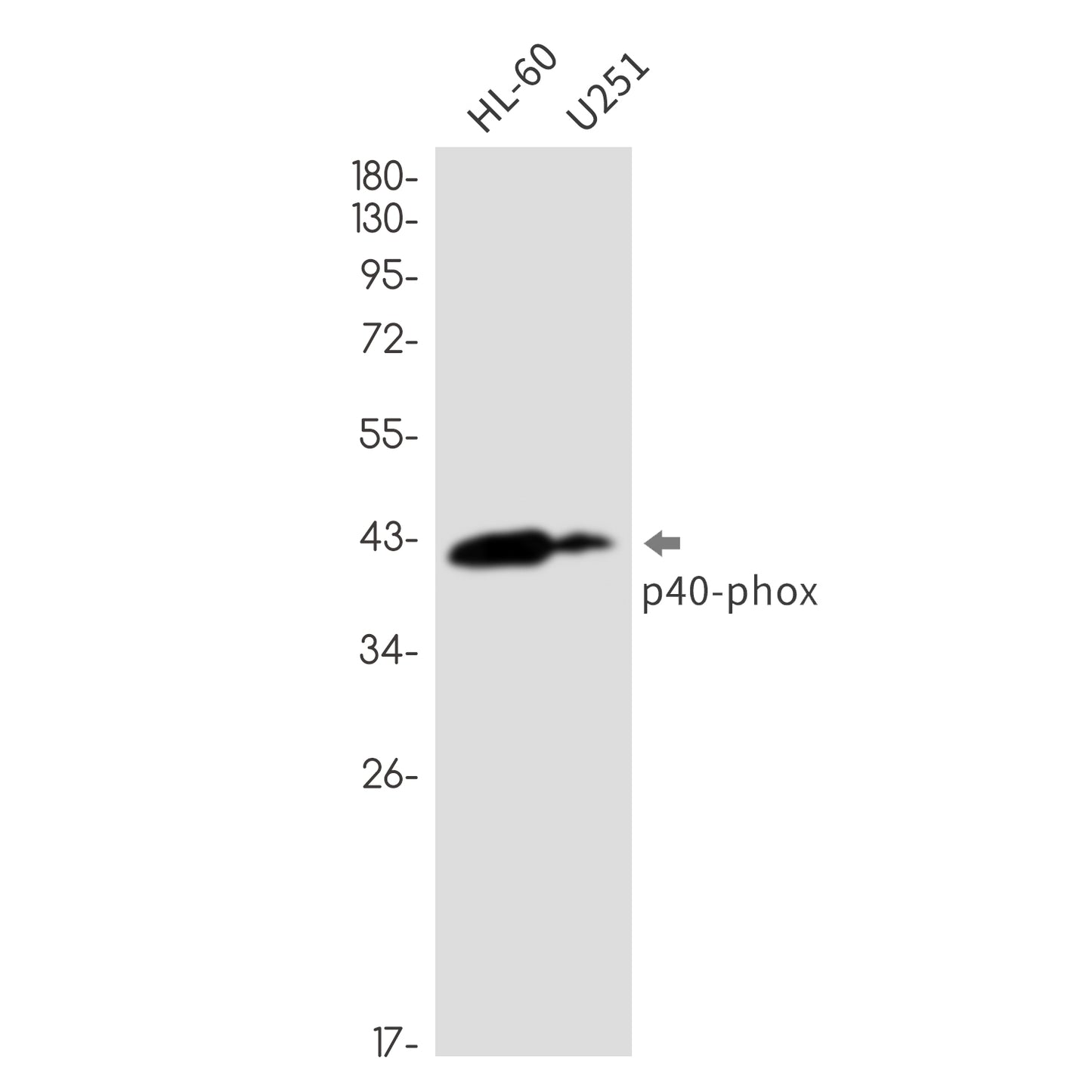 NCF4 Rabbit Monoclonal Antibody