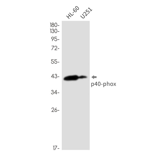 NCF4 Rabbit Monoclonal Antibody