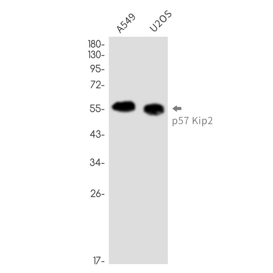 p57 Kip2 Rabbit Monoclonal Antibody