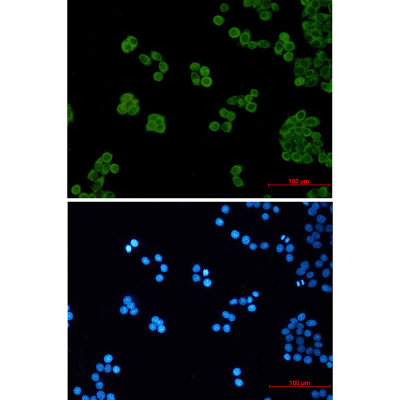 PEN2 Rabbit Monoclonal Antibody