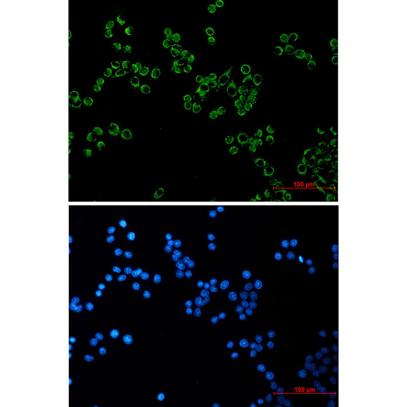 Peroxiredoxin 3 Rabbit Monoclonal Antibody