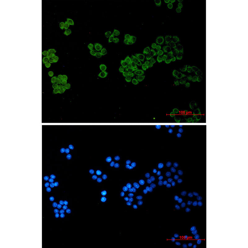 Phospholipase C gamma 1 Rabbit Monoclonal Antibody