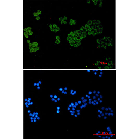 Phospholipase C gamma 1 Rabbit Monoclonal Antibody