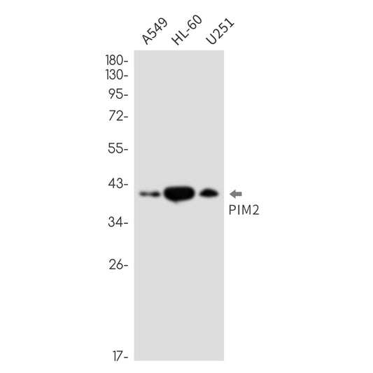 PIM2 Rabbit Monoclonal Antibody