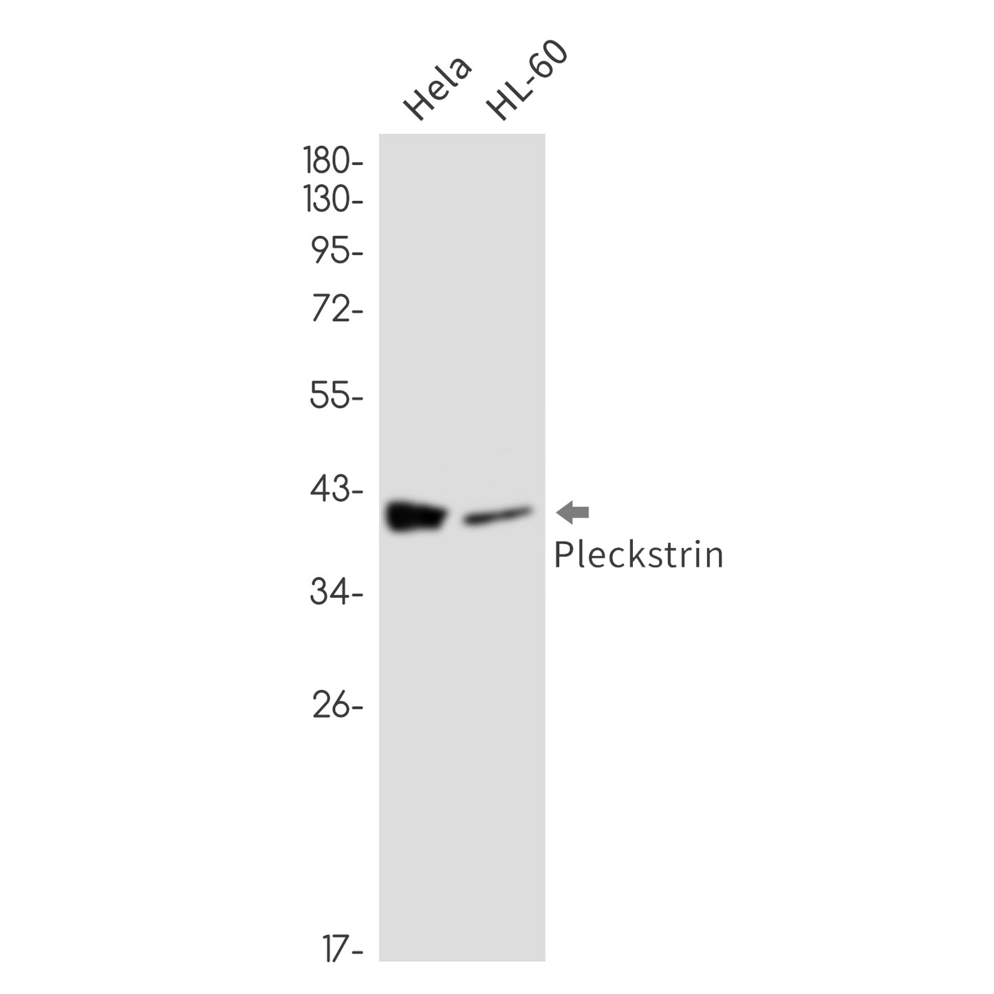 Pleckstrin Rabbit Monoclonal Antibody