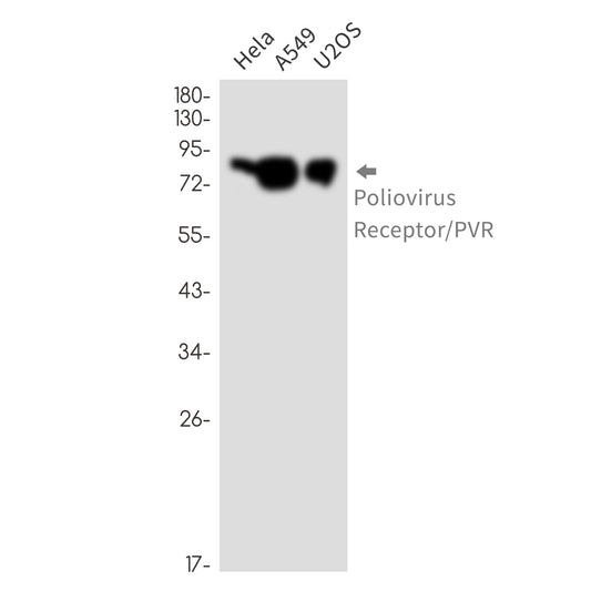 Poliovirus Receptor Rabbit Monoclonal Antibody