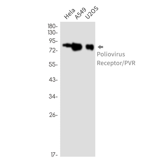 Poliovirus Receptor Rabbit Monoclonal Antibody