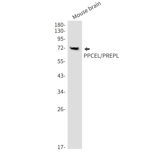 PPCEL Rabbit Monoclonal Antibody