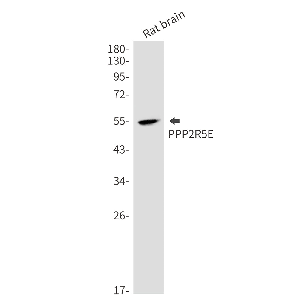 PPP2R5E Rabbit Monoclonal Antibody