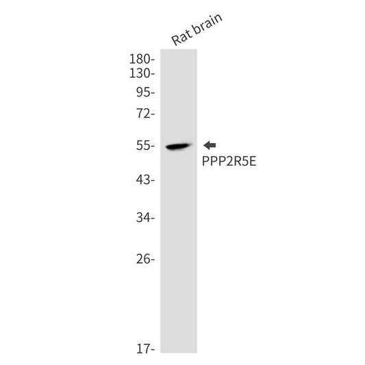 PPP2R5E Rabbit Monoclonal Antibody