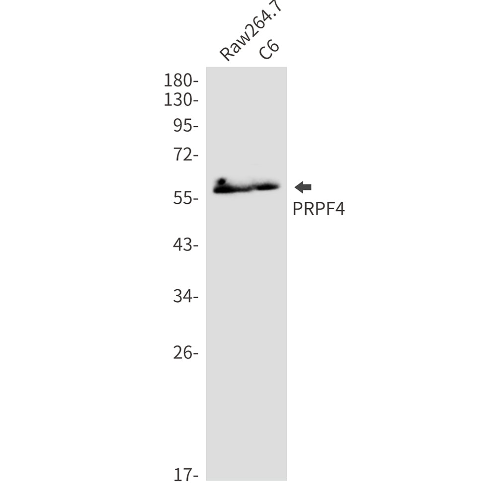 PRPF4 Rabbit Monoclonal Antibody