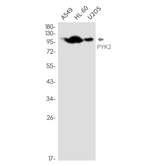 PYK2 Rabbit Monoclonal Antibody