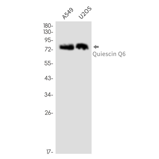 QSOX1 Rabbit Monoclonal Antibody