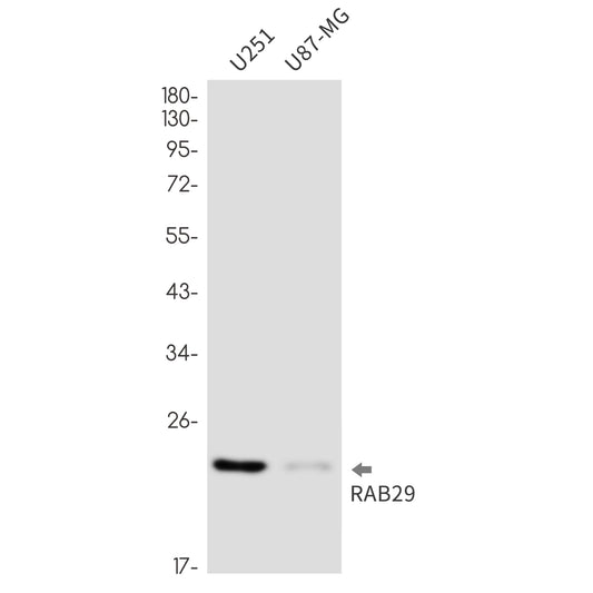 Rab29 Rabbit Monoclonal Antibody