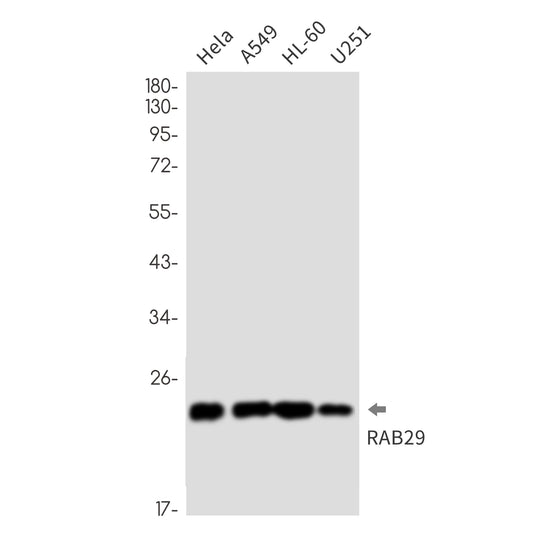 Rab29 Rabbit Monoclonal Antibody
