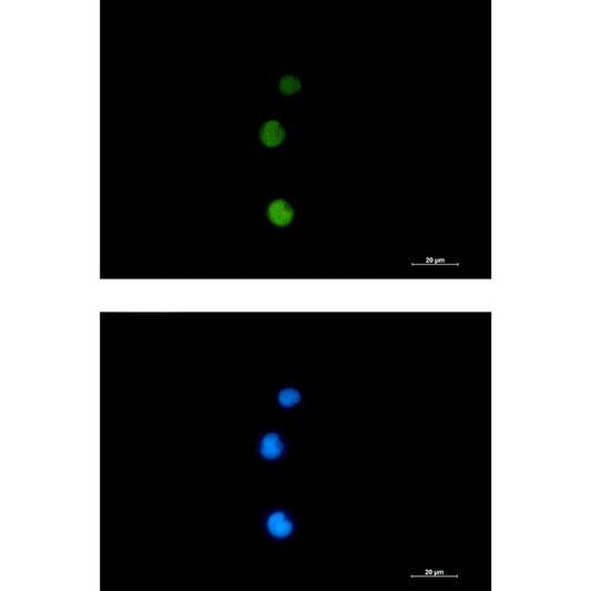Rad51 Rabbit Monoclonal Antibody