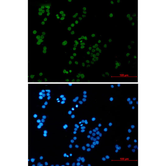 RAP80 Rabbit Monoclonal Antibody