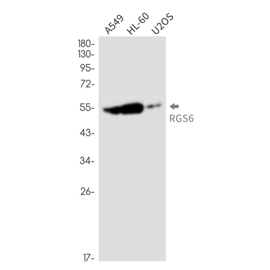 RGS6 Rabbit Monoclonal Antibody