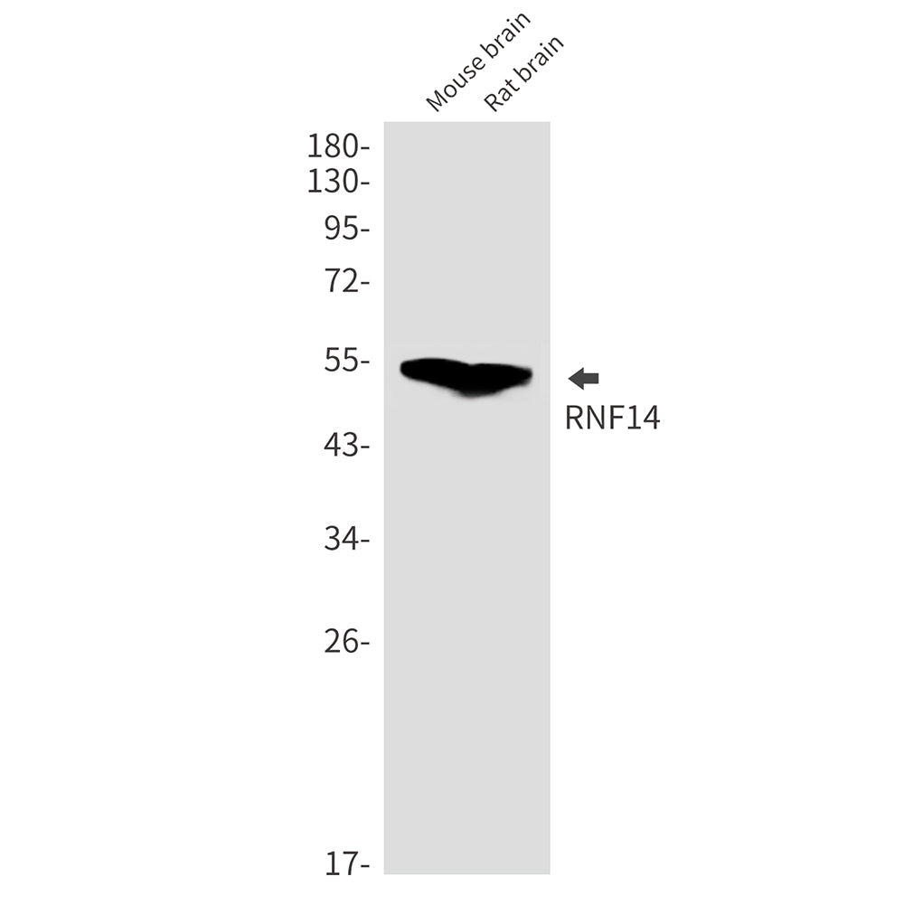 RNF14 Rabbit Monoclonal Antibody