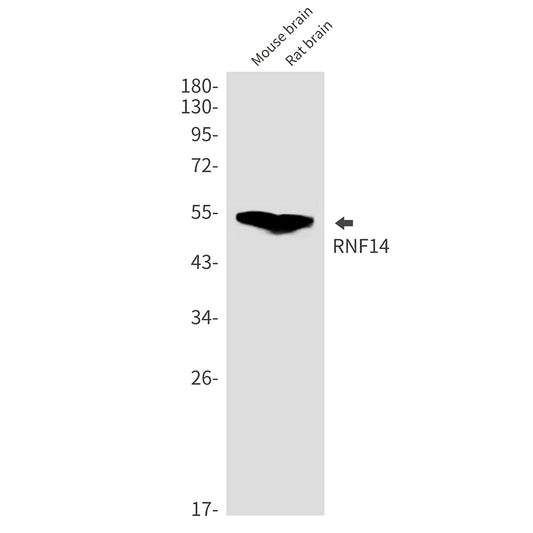 RNF14 Rabbit Monoclonal Antibody
