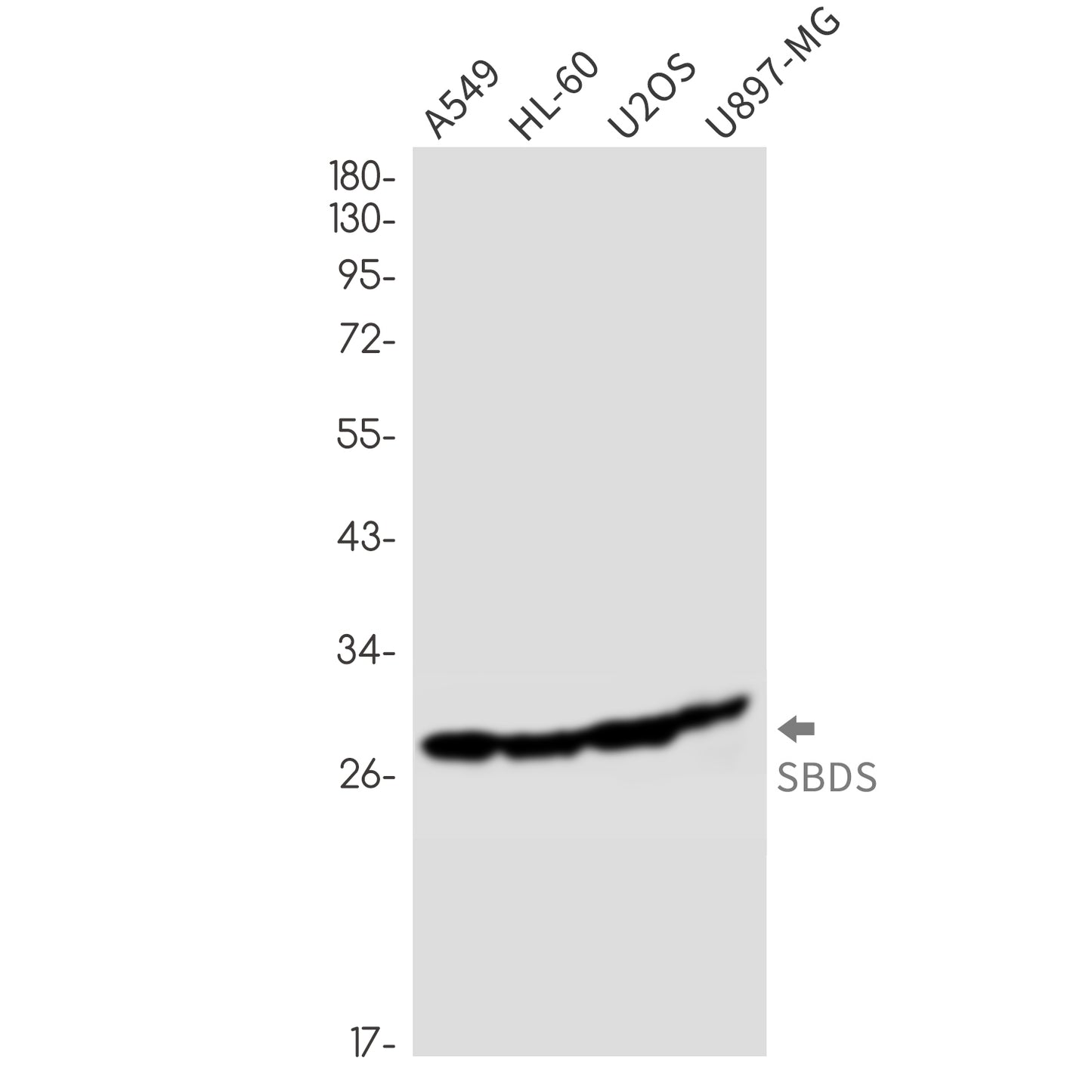 SBDS Rabbit Monoclonal Antibody