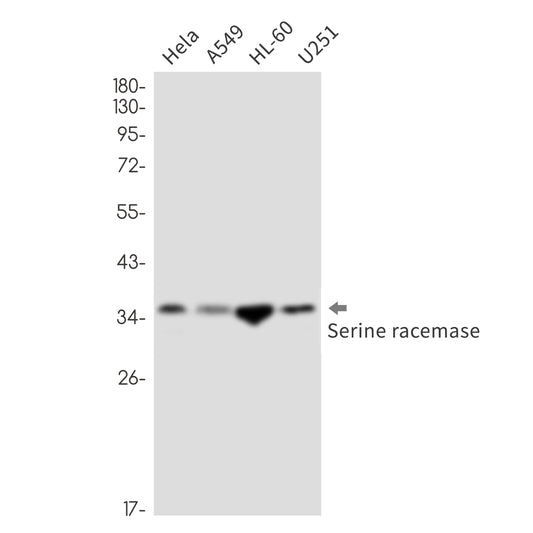 Serine Racemase Rabbit Monoclonal Antibody