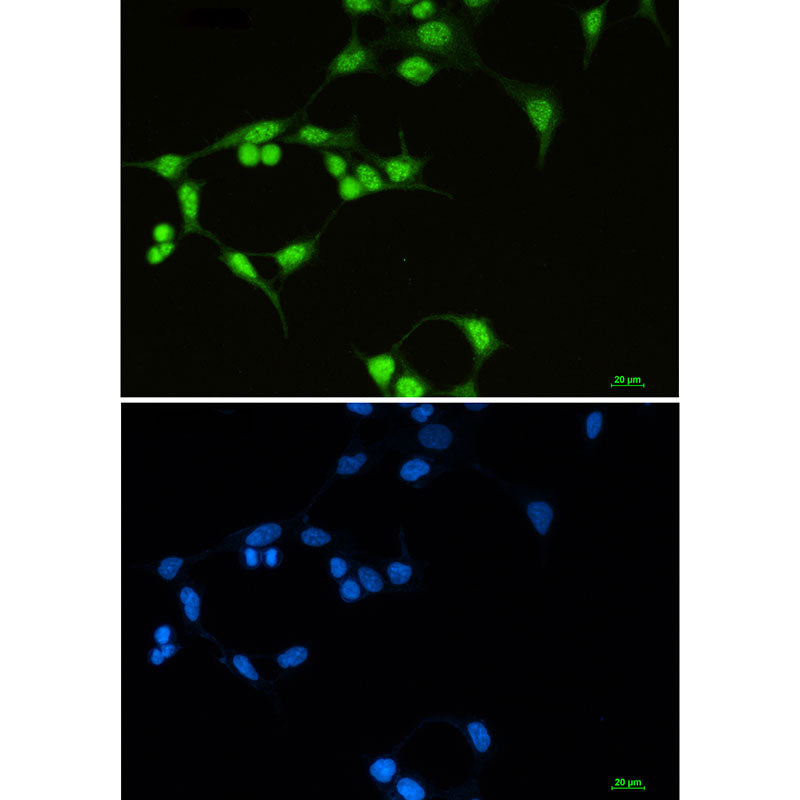 SF3B1 Rabbit Monoclonal Antibody