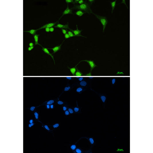 SF3B1 Rabbit Monoclonal Antibody