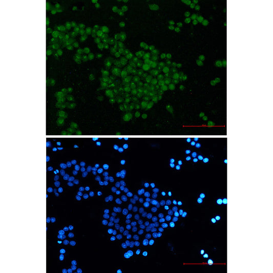SKP2 Rabbit Monoclonal Antibody