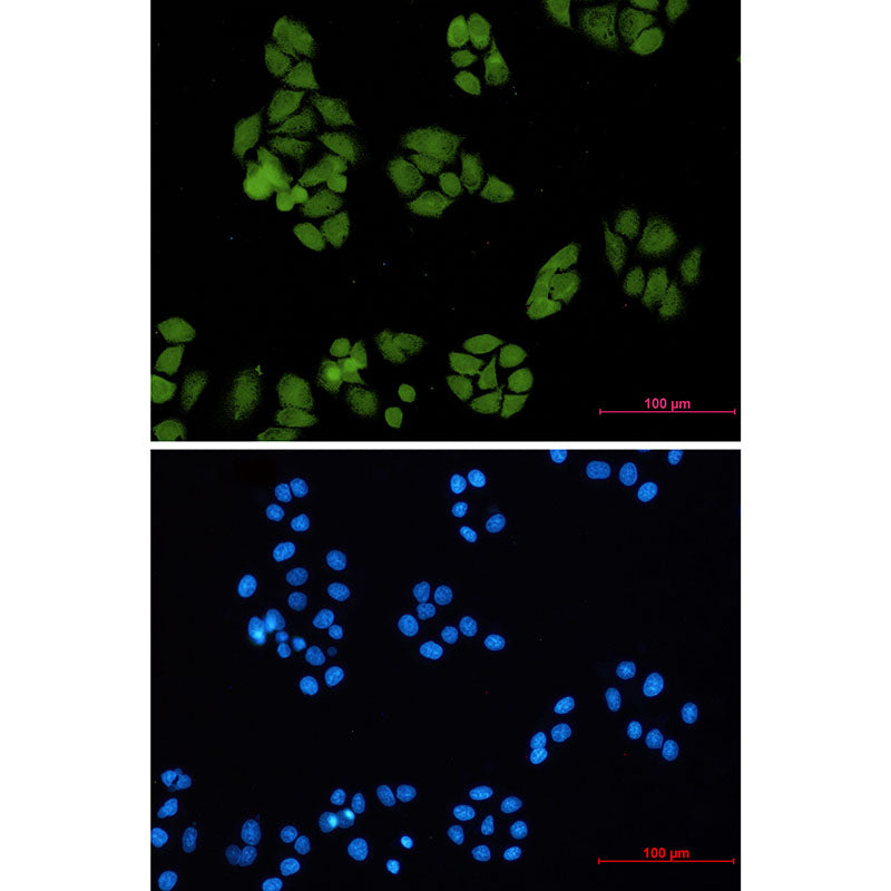 Smad4 Rabbit Monoclonal Antibody