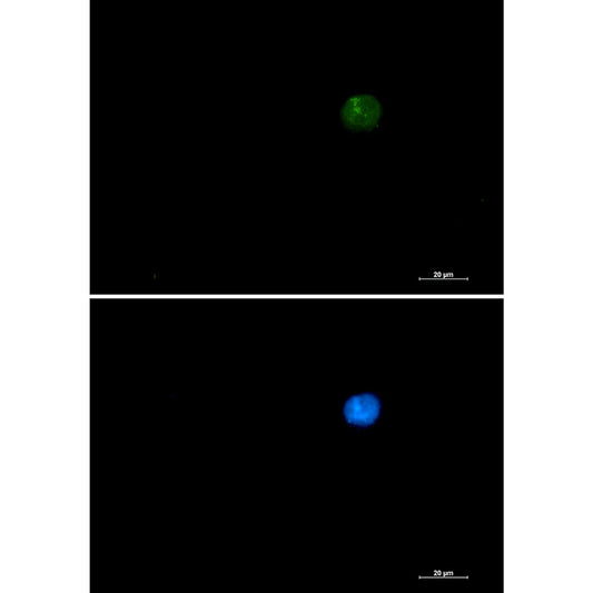 SMARCA2 Rabbit Monoclonal Antibody