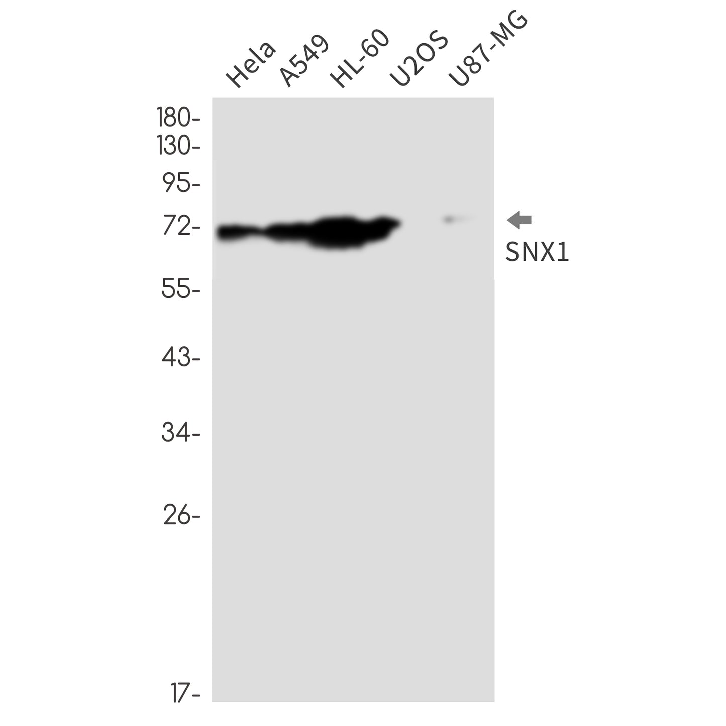 SNX1 Rabbit Monoclonal Antibody