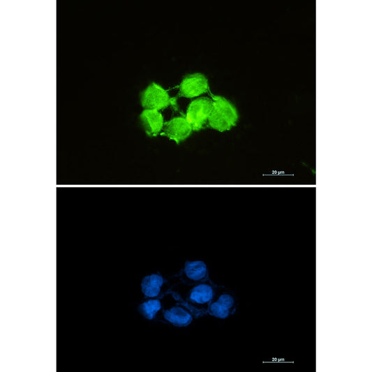 Superoxide Dismutase 1 Rabbit Monoclonal Antibody